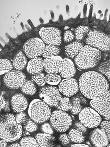 normal mucosa - stomach normal mucosa - stomach